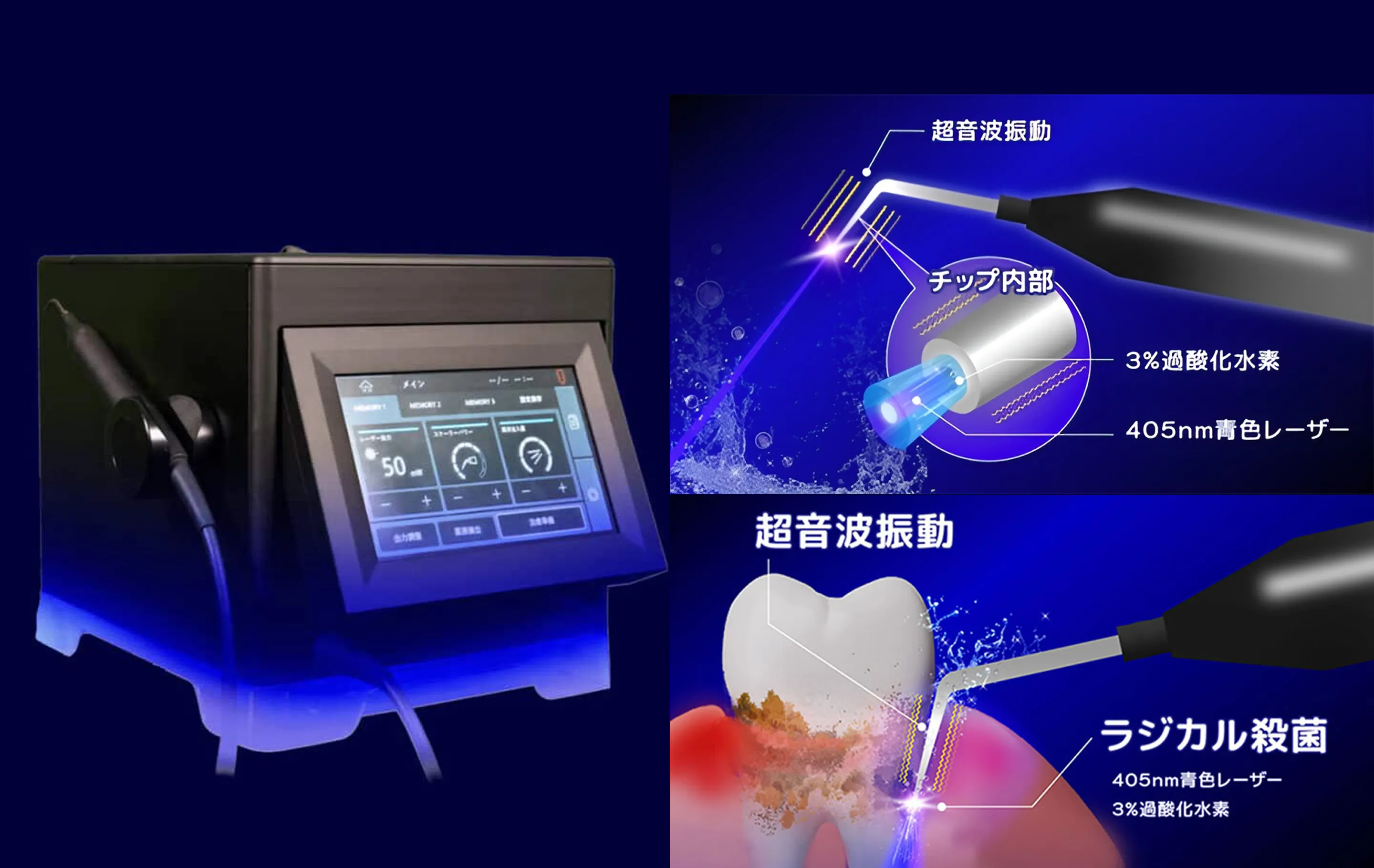 fv-slide02