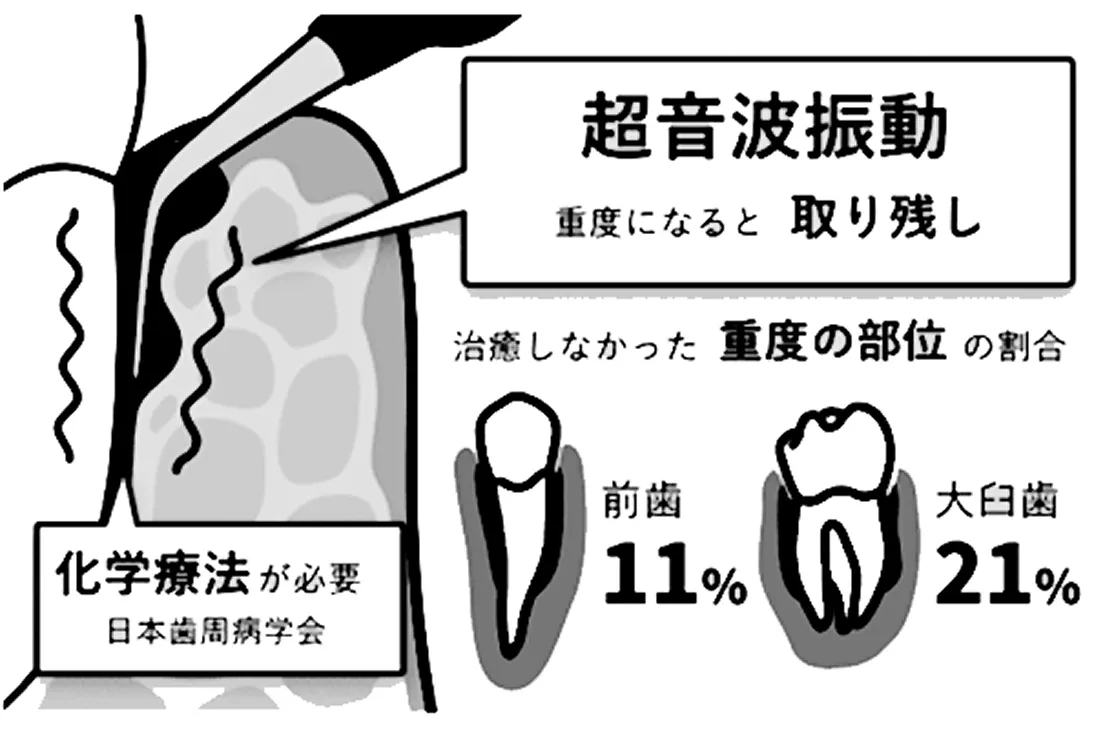 従来の治療法